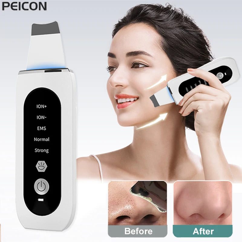 Ultrasonic Skin Scrubber Peeling Blackhead Remover Deep Face Cleaning Ultrasonic Ion Ance Pore Cleaner Facial Shovel Cleanser Peaceful Pleasures Health and Wellness