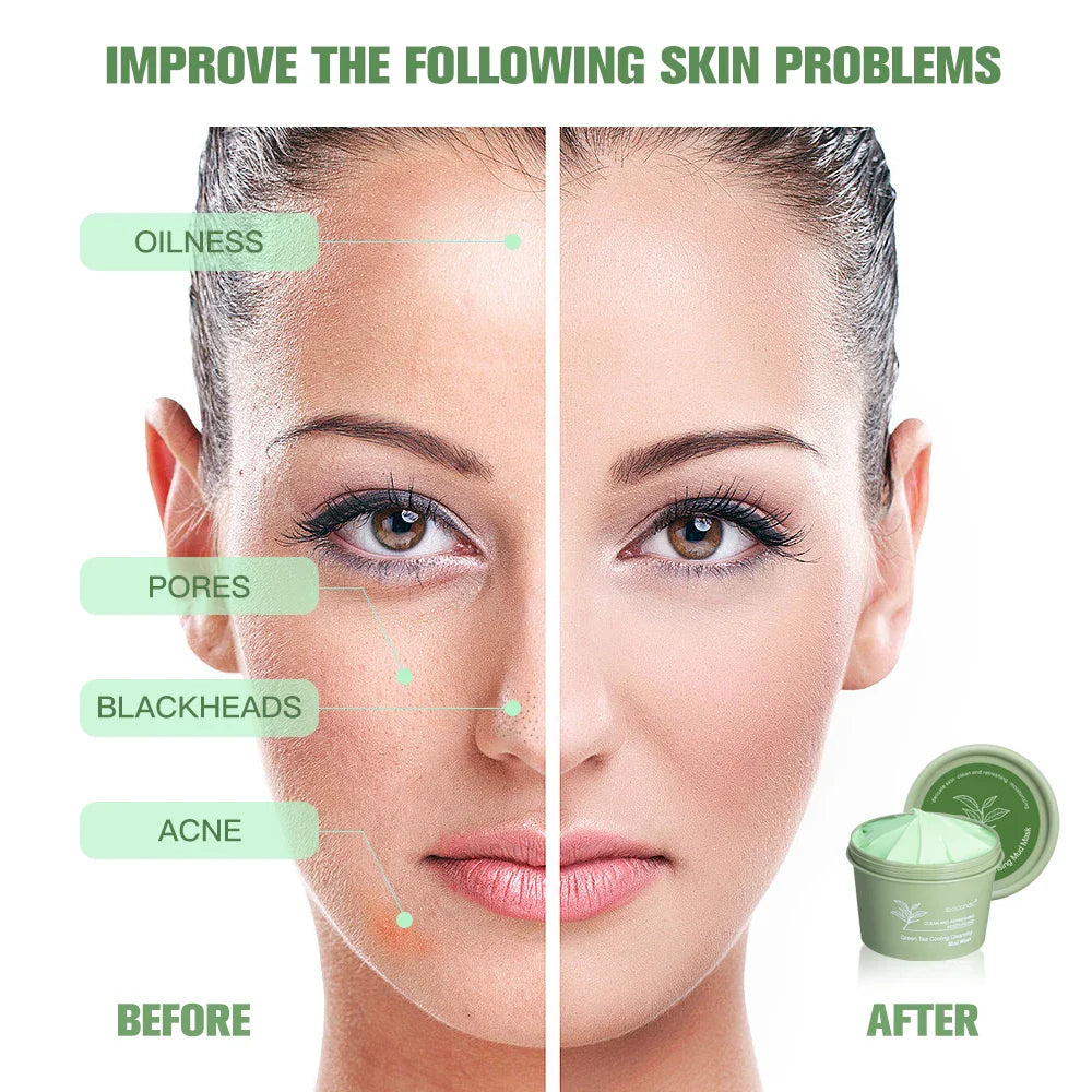 Green Tea Mud Clay Face Mask – Deep Pore Cleansing 100g
