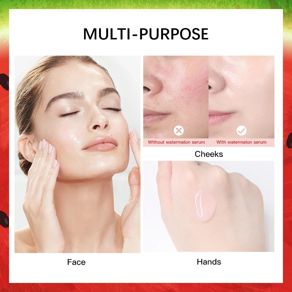 New Watermelon nicotinamide Light Bulb Essence Moisturizing Skin Brightening Face Brightening Essence For Women Skin Care Peaceful Pleasures Health and Wellness