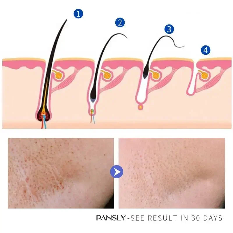 50g Hair Removal Cream for Unisex Reduce Hair Growth Removal Permanent Cream Beard Intimate Legs Body Armpit Painless Depilatory Peaceful Pleasures Health and Wellness