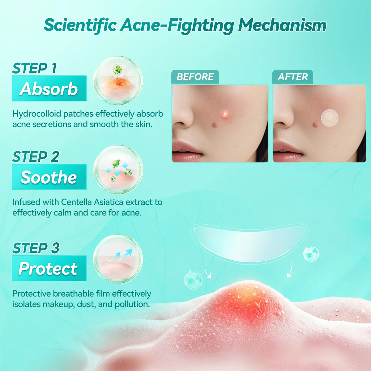 LANBENA Acne Pimple Patch Daily Use Invisible Acne Stickers Blemish Treatment Acne Concealer Makeup Peaceful Pleasures Health and Wellness