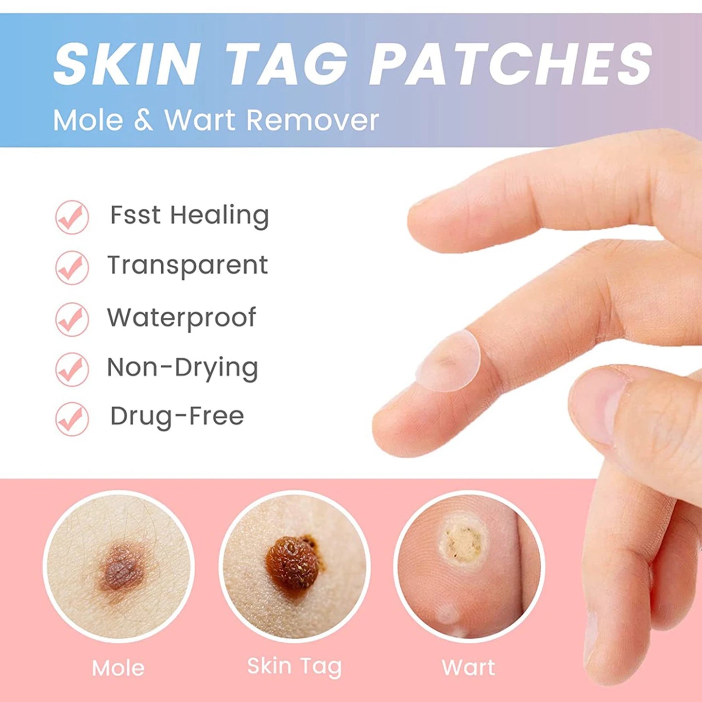 2025 New Hot Sale 72Pcs Invisible Removal Pimple Anti-Acne Hydrocolloid Patches Spots Marks Concealer Waterproof Repair Sticker Peaceful Pleasures Health and Wellness