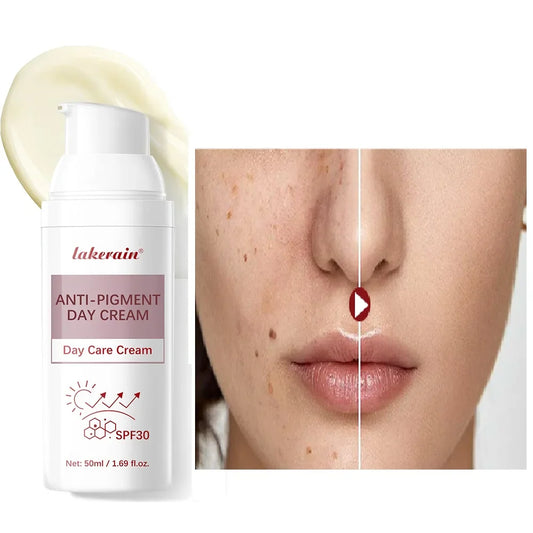 Anti-Pigment Day Cream SPF 30 | Brightening & Even Skin Tone Brightening Day Cream Oasis Select