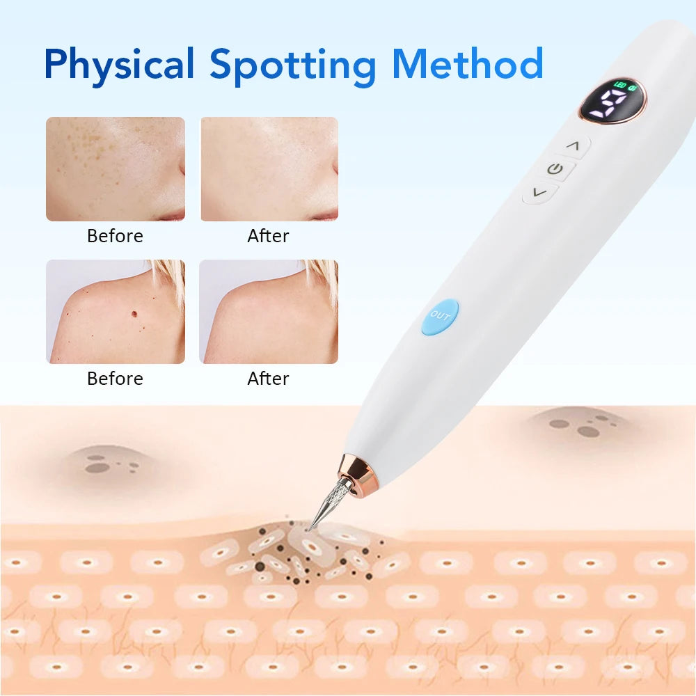 Mole Spot Scanning Removal Pen Beauty Plasma Pen Needle 9-speed Tattoo Removal Household Spot Face Wart Freckle Remover Machine Peaceful Pleasures Health and Wellness