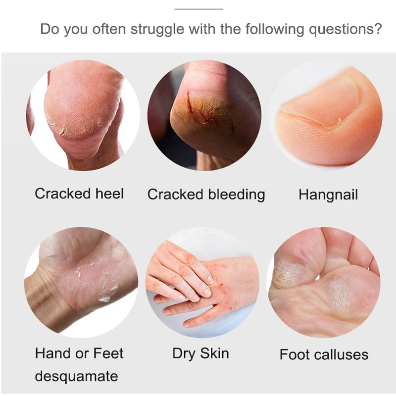 45g*3 Traditional Chinese Clam Oil Hand&Foot Cream Anti Drying Crack Heel Cracked Repair Cream Removal Dead Skin Hand Feet Care Peaceful Pleasures Health and Wellness