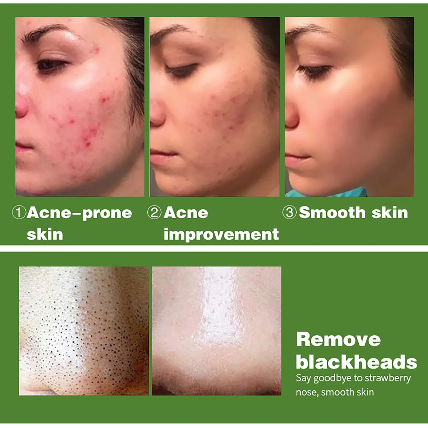 AILKE Salicylic Acid Clarifying Face Serum – All Skin Types 40ml