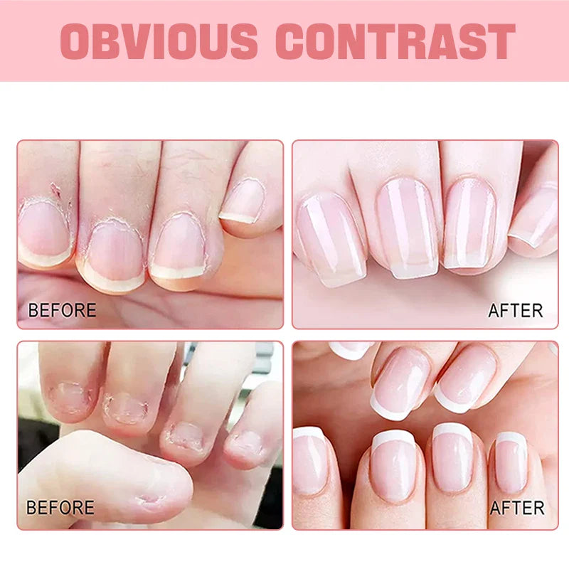 Nail & Cuticle Oil – Moisturizing, Strengthening & Hydrating