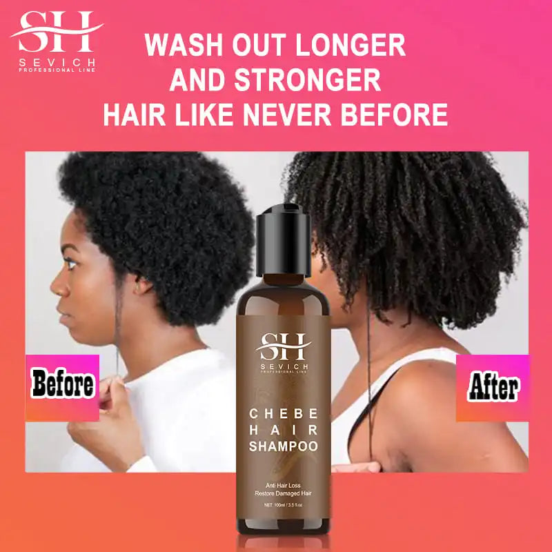 CHEBE Hair Growth Shampoo Conditioner Set Anti Hair Loss Treatment for Men Women Fast Thicken Regrowth Oil Beauty Health SEVICH Peaceful Pleasures Health and Wellness