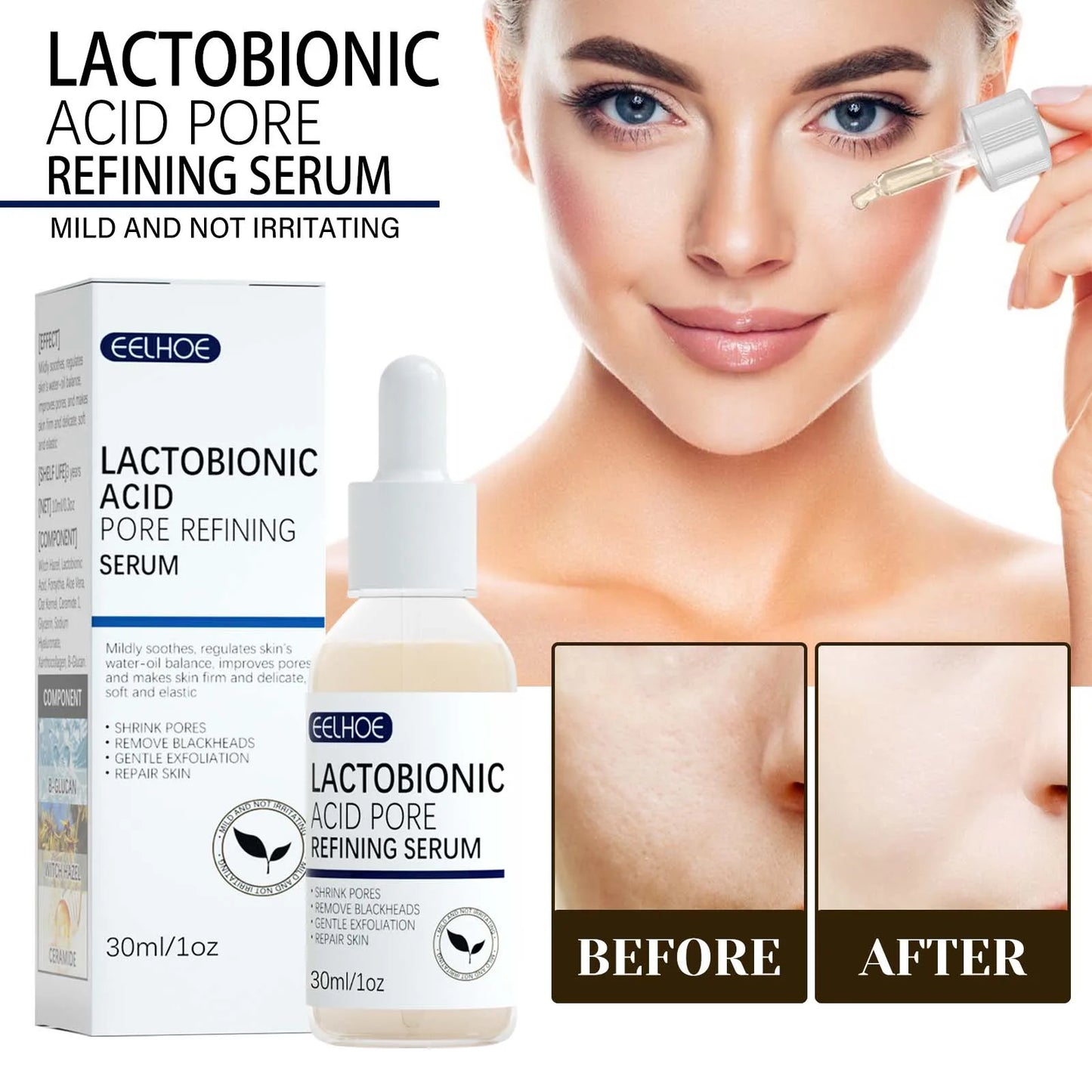 Lactic Acid Pore Shrinking Serum – Blackhead & Brightening 30ml