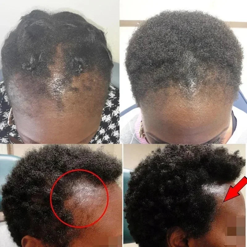 Batana Hair Growth Oil Conditioner Anti Hair Loss Products Fast Growing Hair Mask Nourishing Repair Roots Hair Care for women Peaceful Pleasures Health and Wellness
