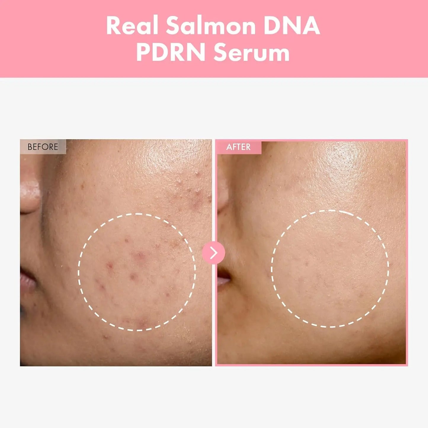 2pcs Pdrn Pink Peptide Serum Targets Dark Spots Strengthens The Skin's Barrier Peaceful Pleasures Health and Wellness