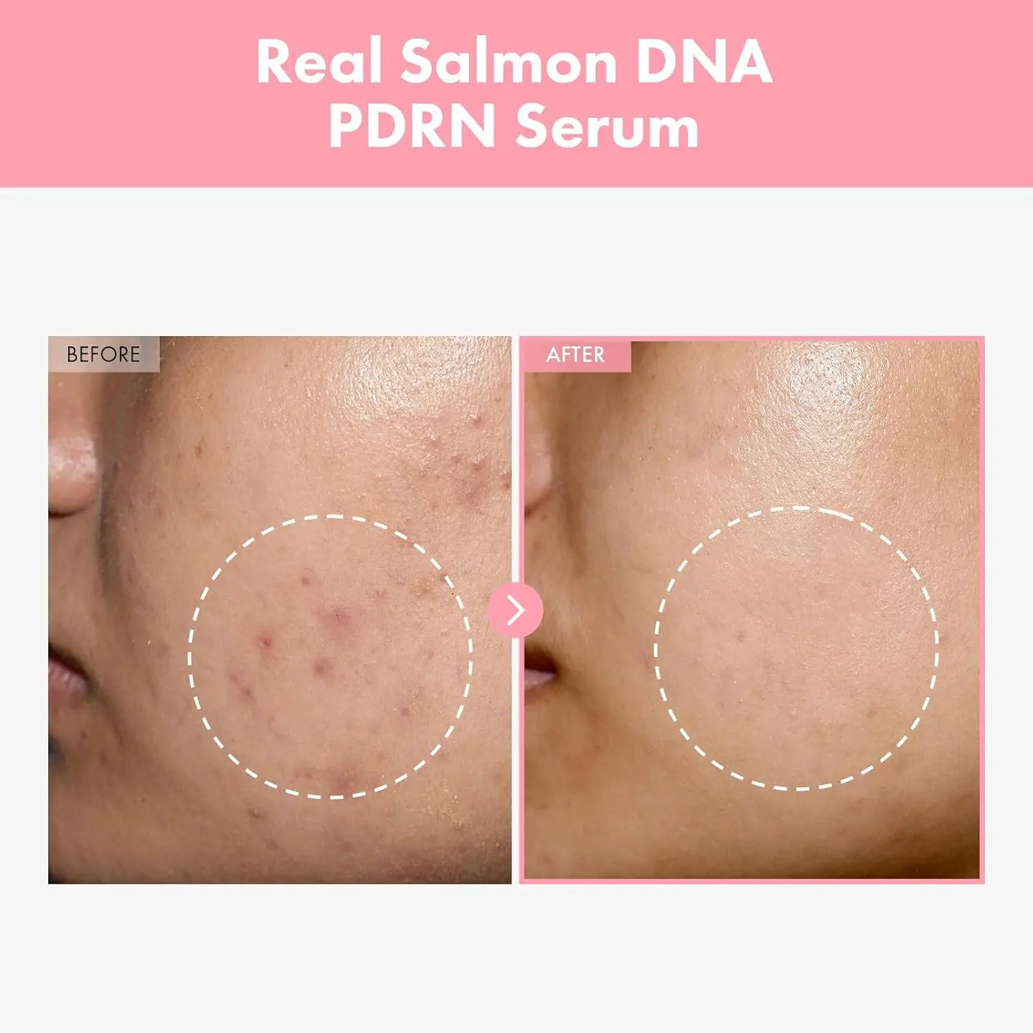 2pcs Pdrn Pink Peptide Serum Targets Dark Spots Strengthens The Skin's Barrier Peaceful Pleasures Health and Wellness