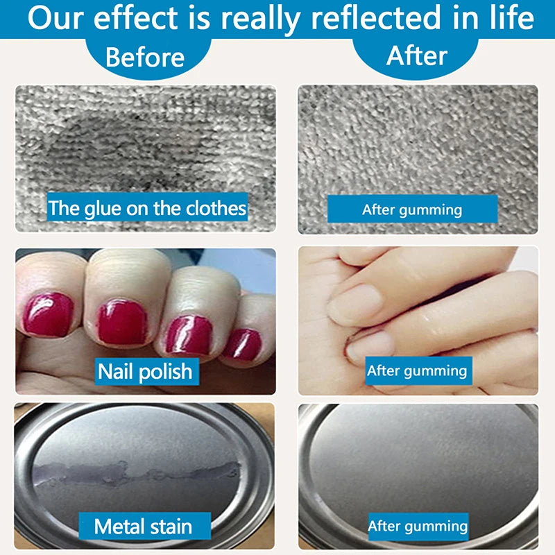 Multipurpose Gel Glue Remover – Fast-Acting Adhesive Solvent