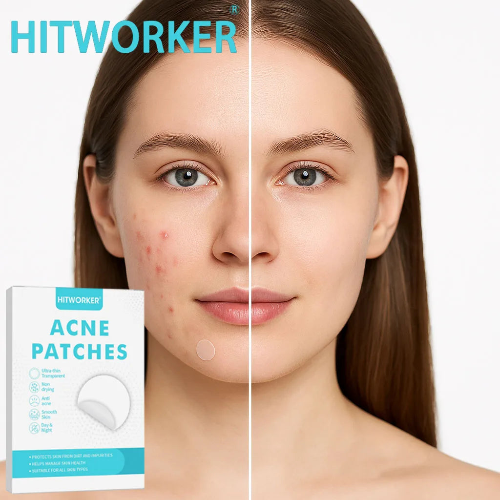 Invisible Waterproof Hydrocolloid Acne Patches – All Skin Types