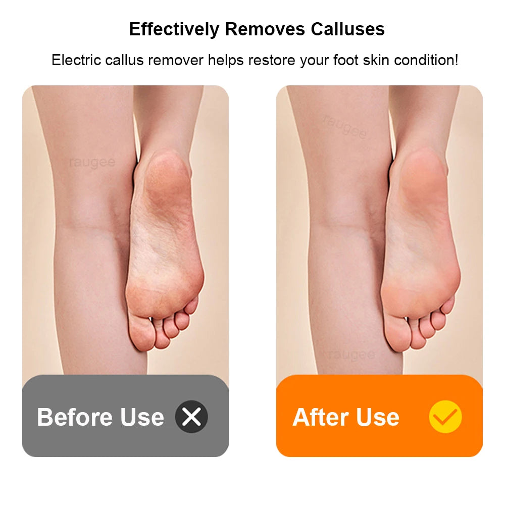 Electric Foot Grinder Portable Electric Callus Remover for Feet Foot Exfoliation Sander Rechargeable Electric Foot File Pedicure Peaceful Pleasures Health and Wellness