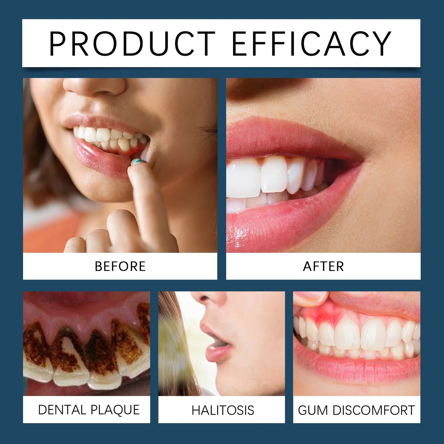 Botanical Gum Soothing Gel | Fresh Breath Oral Care Essence