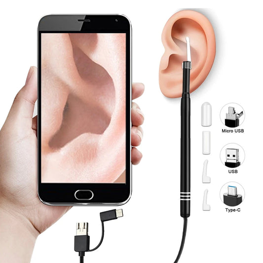 Smart Visual Medico Otoscopio Ear Cleaner Ear Endoscope Earpick Camera Ear Wax Remover Tool Ear Picker Ear Stick beleza e saude Peaceful Pleasures Health and Wellness