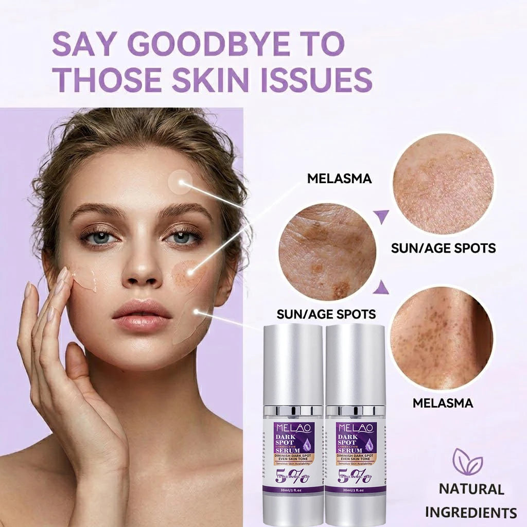 Dark Spot Remover for Face,Dark Spot Corrector Serum for Age Spot Sun Spot Freckles Melasma Brown Spot Skin Care Repair Cream Peaceful Pleasures Health and Wellness