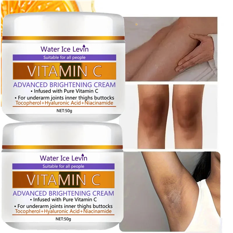 Vitamin C Brightening Body Cream – Underarm & Dark Spots