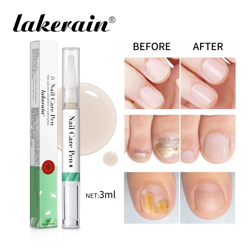 Nail Care Pen Nourish and Moisturize Nails Prevent Fungal Infections Improve Appearance Flat Brush Head Design Daily Nail Care Peaceful Pleasures Health and Wellness