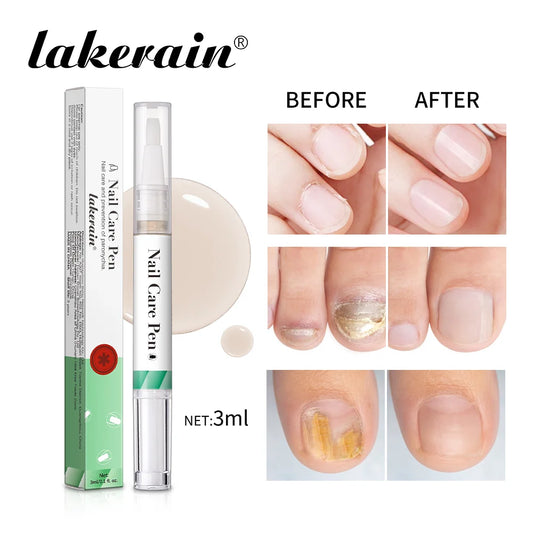 Nail Care Pen Nourish and Moisturize Nails Prevent Fungal Infections Improve Appearance Flat Brush Head Design Daily Nail Care Peaceful Pleasures Health and Wellness
