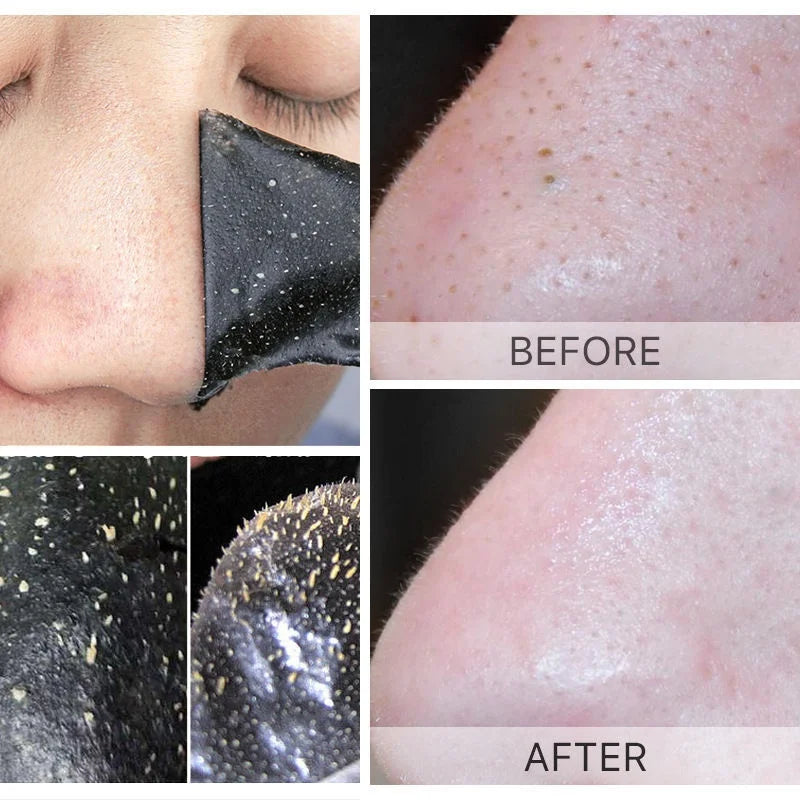 Unisex Blackhead Remove Mask Peel Nasal Strips Deep Shrink Cleansing Pore Nose Black Head Remove Stickers Skin Care Mask Patch Peaceful Pleasures Health and Wellness