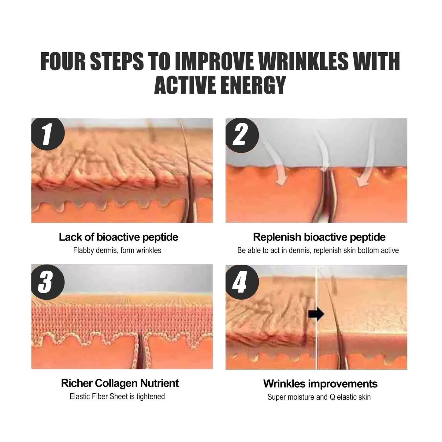 Silicone Anti-Wrinkle Firming Patches – Forehead & Crow's Feet