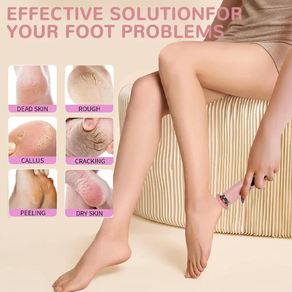 Professional Foot Scrubber Sander Grinder For Dead Skin Cracked Heel Pedicure Tool Electric Foot File Callus Remover For Feet Peaceful Pleasures Health and Wellness