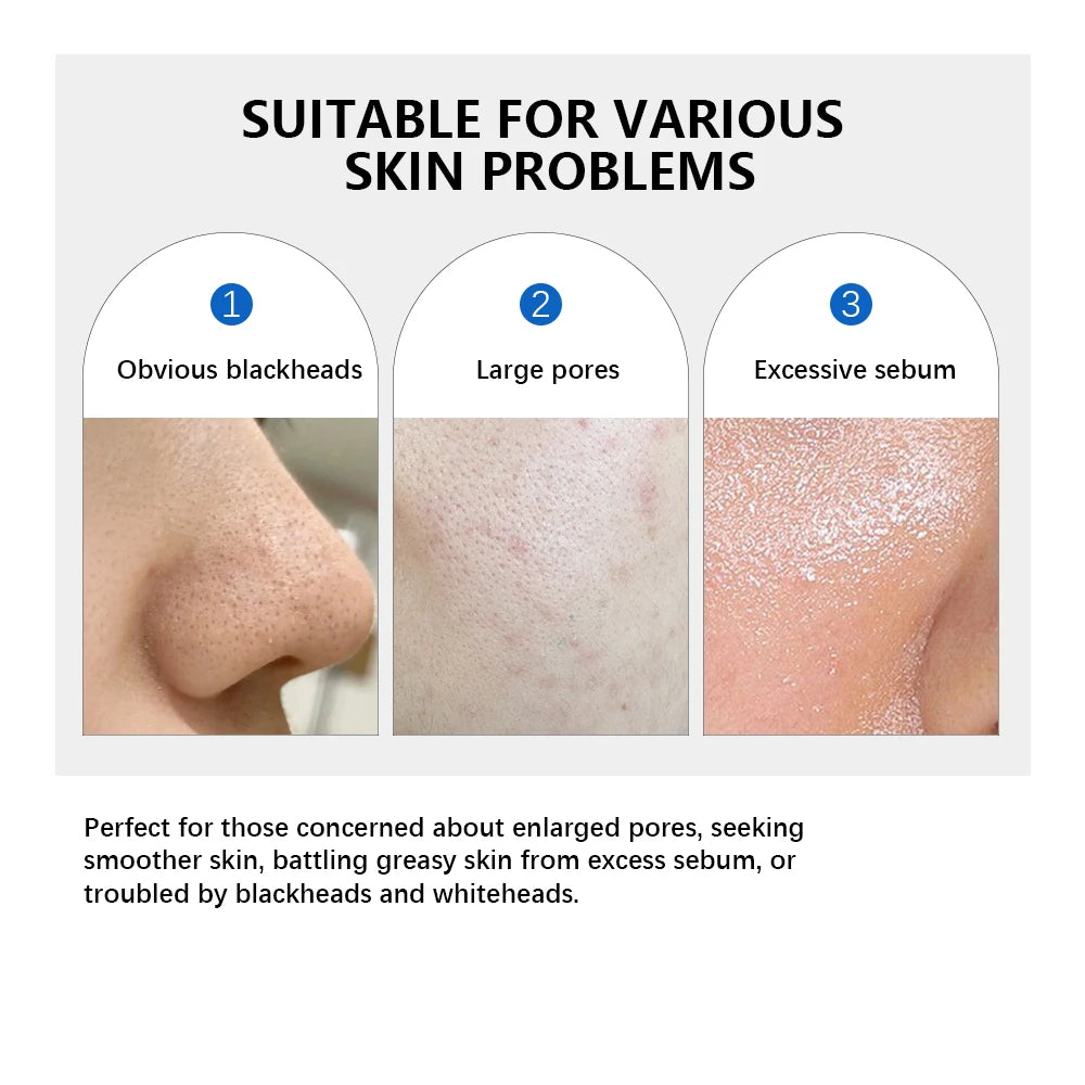 Zero Pore Pad 2.0 Double Textured Facial Toner For Exfoliating And Smoothing Pores Korean Skin Care Pad For All Skin Types 70pcs Peaceful Pleasures Health and Wellness