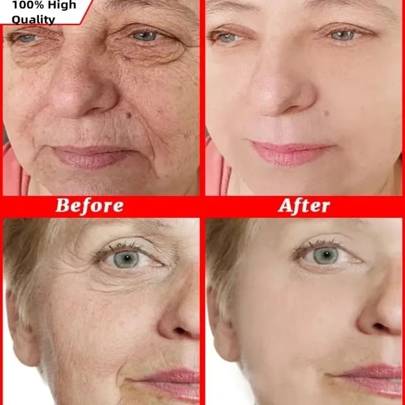 20-Pack Hyaluronic Acid Capsule Serum – Anti-Aging & Brightening
