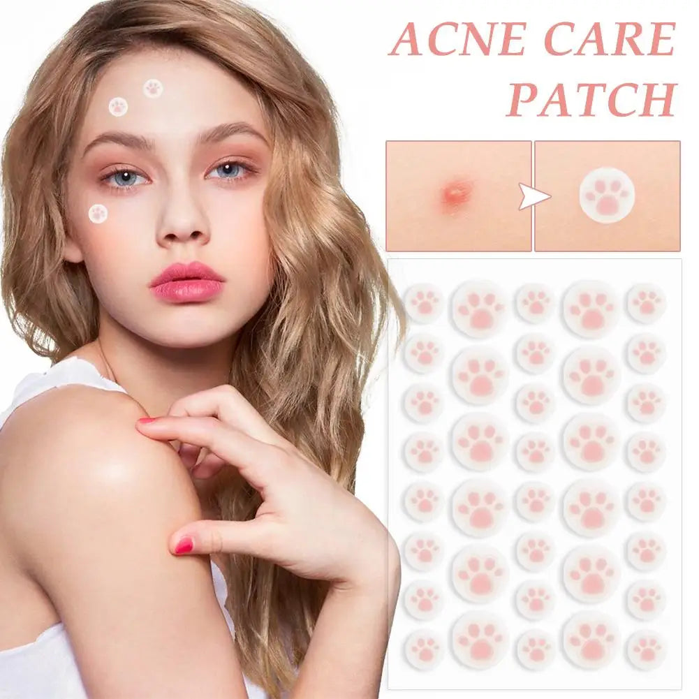 Acne Pimple Patches 36ct | K-Beauty Daytime Zit Covers