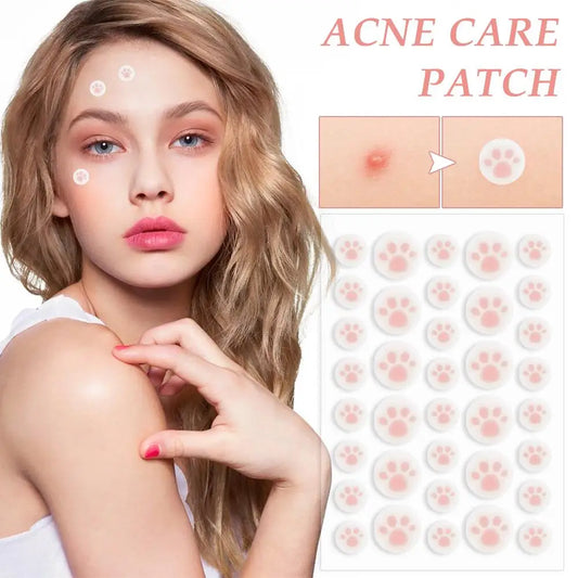 Acne Pimple Patches 36ct | K-Beauty Daytime Zit Covers Acne Pimple Patches Peaceful Pleasures Health and Wellness