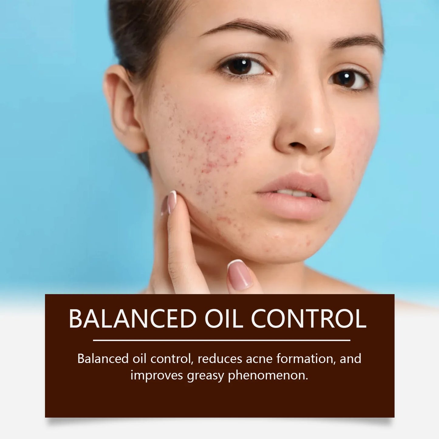 Herbal Acne Face Cream – Oil Control & Blemish Care 20g