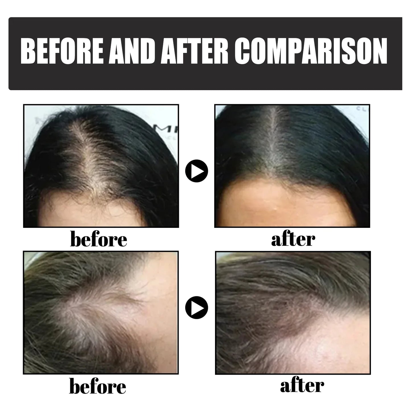 EELHOE Hair Building Fibers – Hairline Filler & Powder 12g