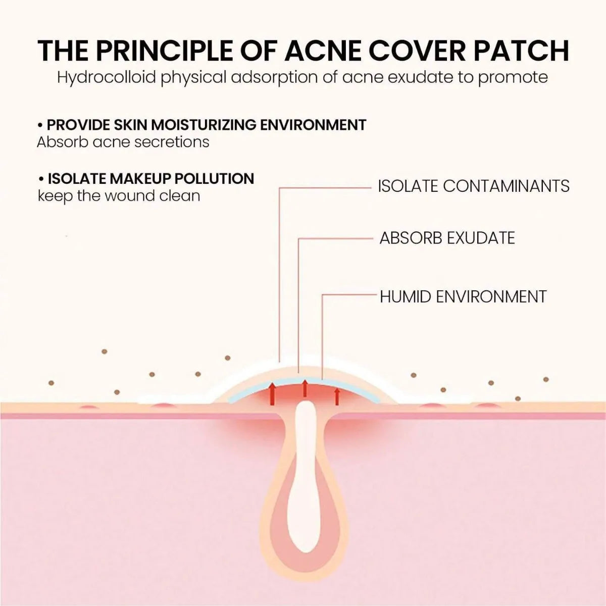 200pcs Star Acne Patch Facial Skin Care Fade Blemishes Pimple Marks Closed Acne Blemishes Cover Acne Pimple Repair Patch Peaceful Pleasures Health and Wellness