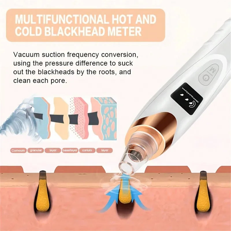 Electric Blackhead Remover Vacuum | 5-Level Pore Cleanser