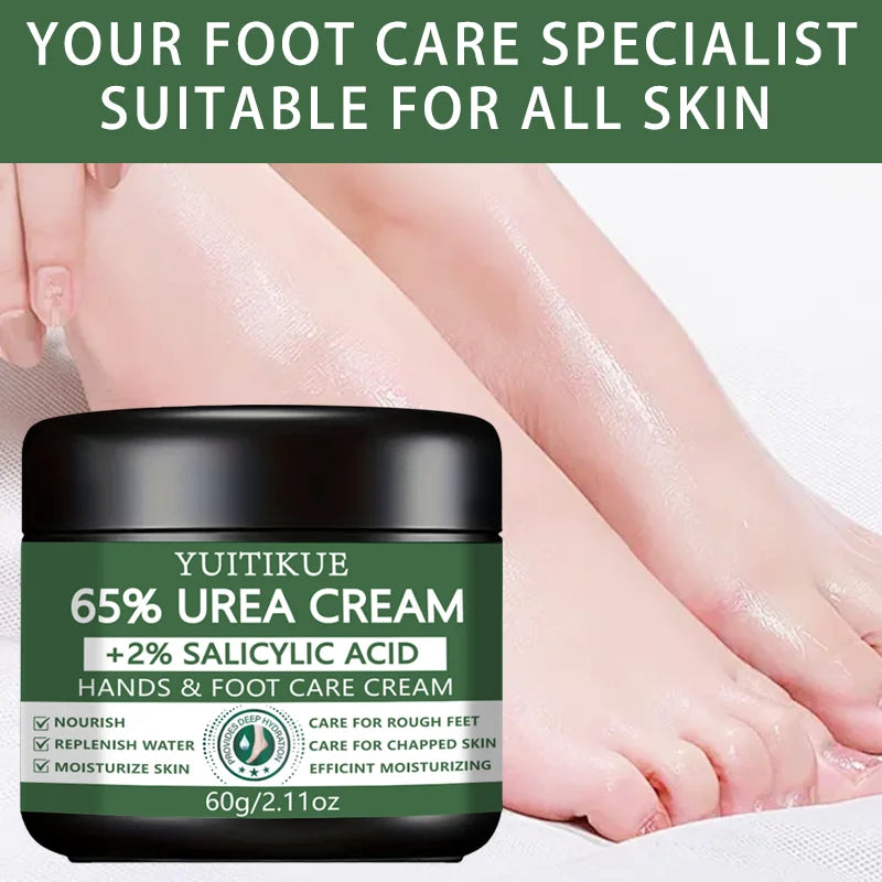 YUlTlKUE 65% Urea Cream +2% salicylic Acid Hands & Foot Care Cream Moisturize Rough chapped skin Nourish Hydrate 60g Peaceful Pleasures Health and Wellness