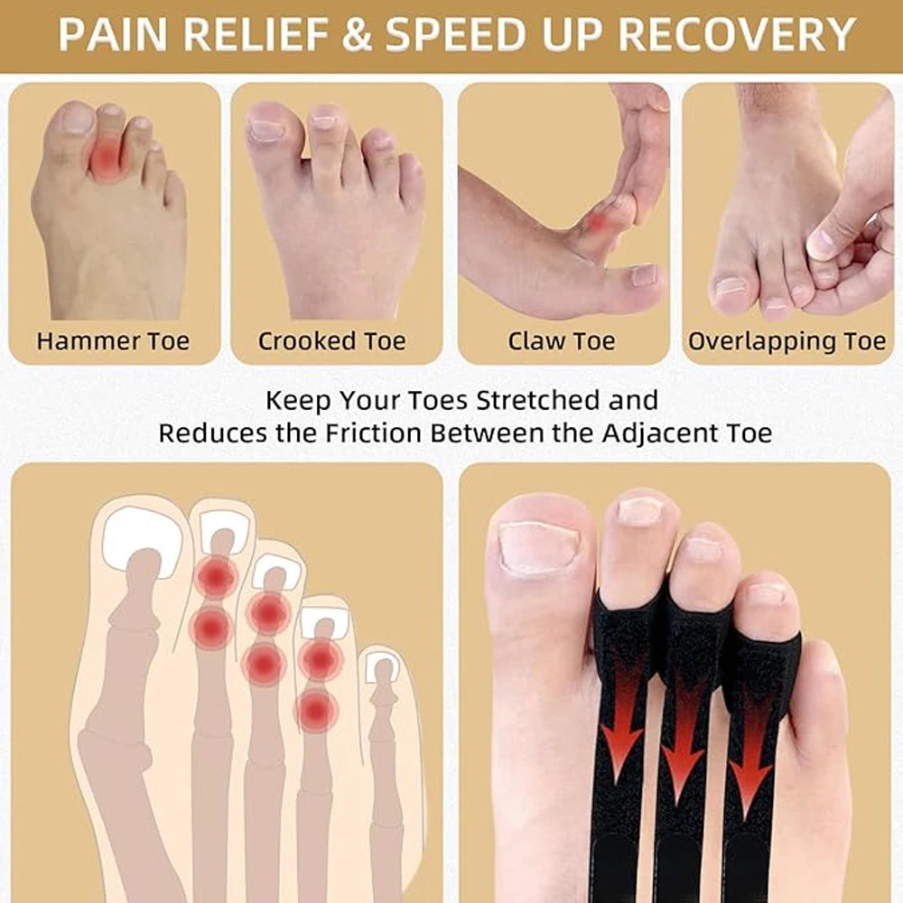 1PC Toe Splint for Plantar Fasciitis -Lightweight Toe Support Brace for Women Men,Targeted Pain Solution for Healing Flat Arches Peaceful Pleasures Health and Wellness