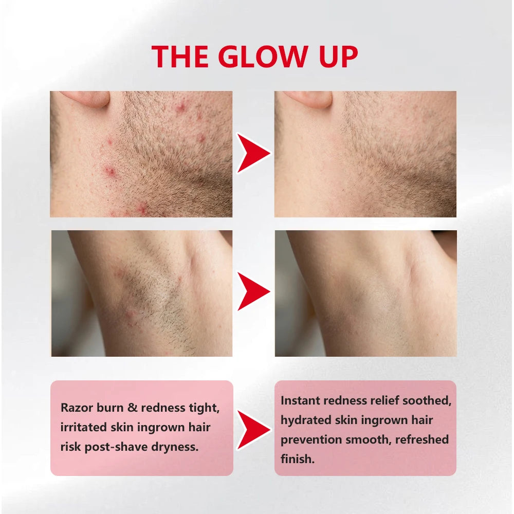 Ingrown Hair Pads Aftershave Treatment Pads to Help Prevent Razor Bumps for Men & Women - Exfoliate Underarms & Bikini Area Peaceful Pleasures Health and Wellness