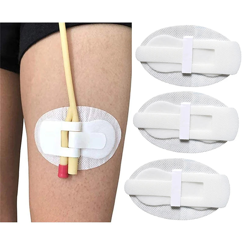 Catheter Holder Tube Sticker Bag Strap Urinary Leg Legband Adhesive Fixing Band Device Anchor G Stabilization Nephrostomy Peaceful Pleasures Health and Wellness