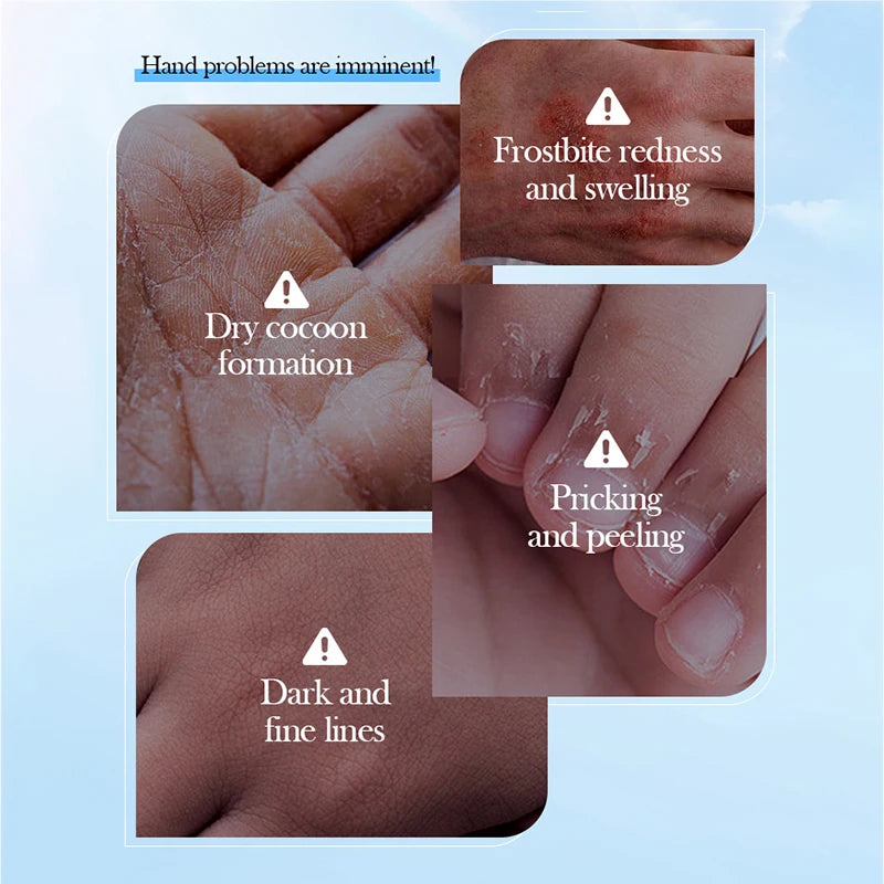 SADOER Coconut Hand Mask Gloves – Moisturizing & Anti-Aging