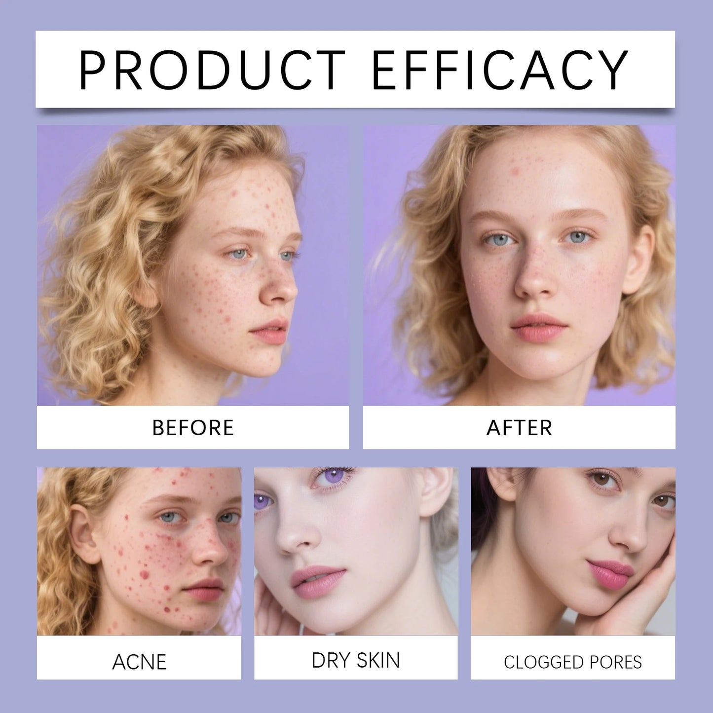 240pcs Salicylic Acid Acne Patches | Hydrocolloid Spot Dots