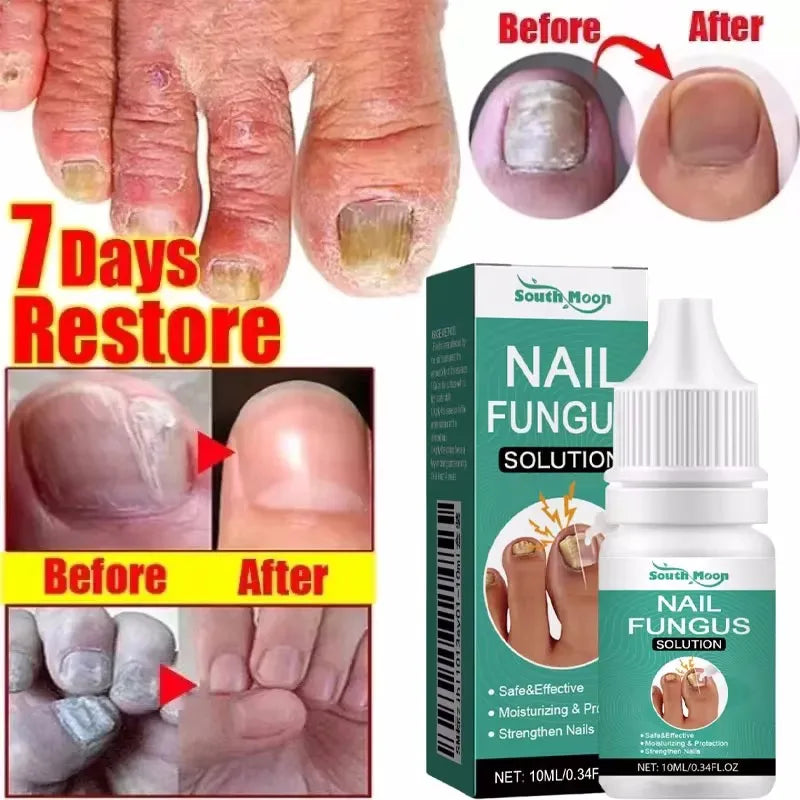 Eelhoe Nail Repair Serum – Ginger Extract for Healthy Nails
