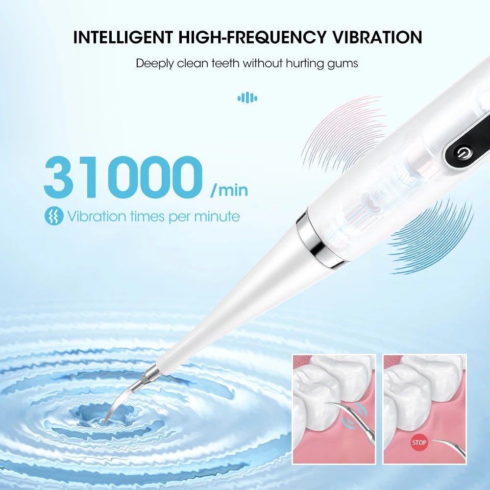 Electric Teeth Cleaner Dental Remover Calculus Plaque Stains and Tartar Oral Care Teeth Whitening Kits Rechargeable Toothbrush Peaceful Pleasures Health and Wellness