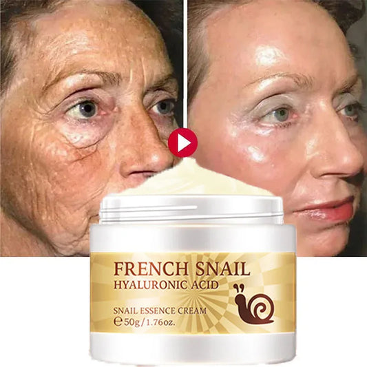 Snail Anti-aging Cream Collagen Remover Wrinkle Fade Fine Lines Repair Face Damaged Lift Firm Smooth Bright Whitening Skin Care Peaceful Pleasures Health and Wellness