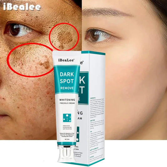 Effective Whitening Freckles Cream Remove Melasma Dark Spots Fade Melanin Pigmentation Moisturizing Brighten Skin Care Products Peaceful Pleasures Health and Wellness Default Title