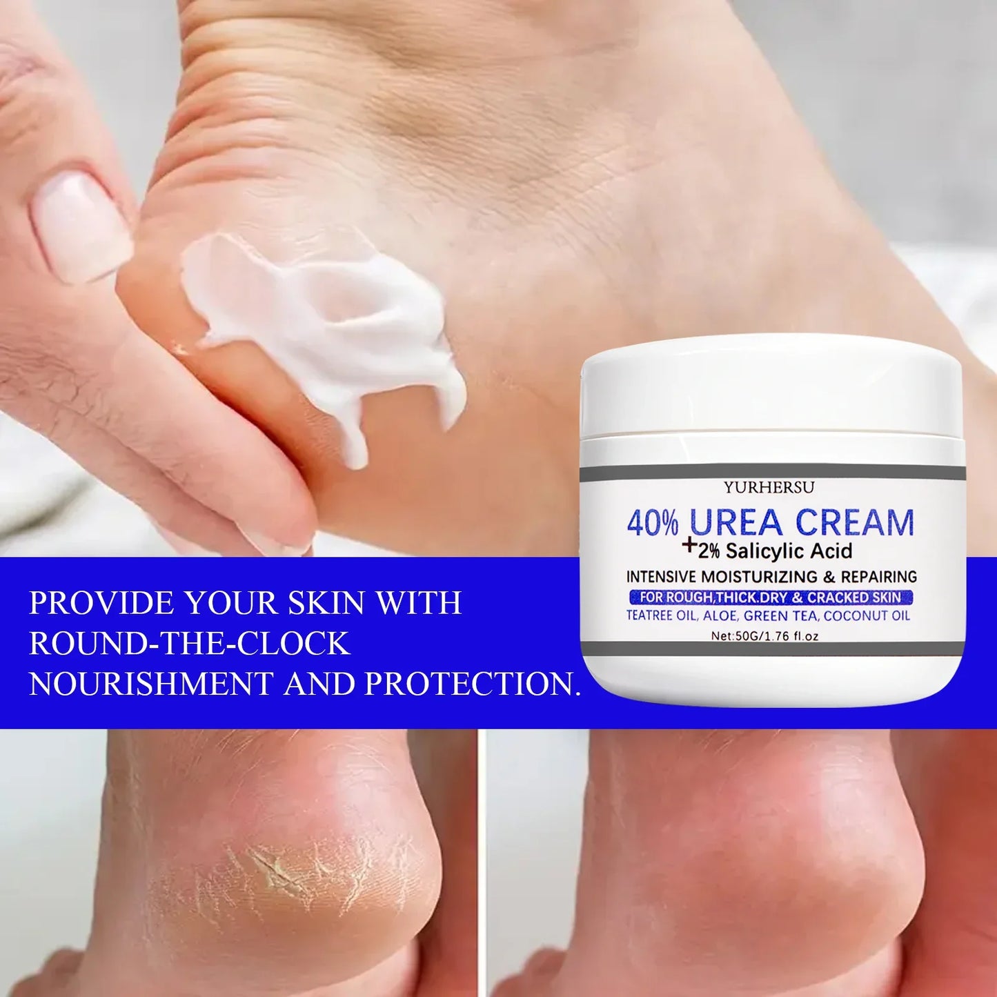 YURHERSU 40% Foot Cream – Exfoliating Dry & Cracked Heels