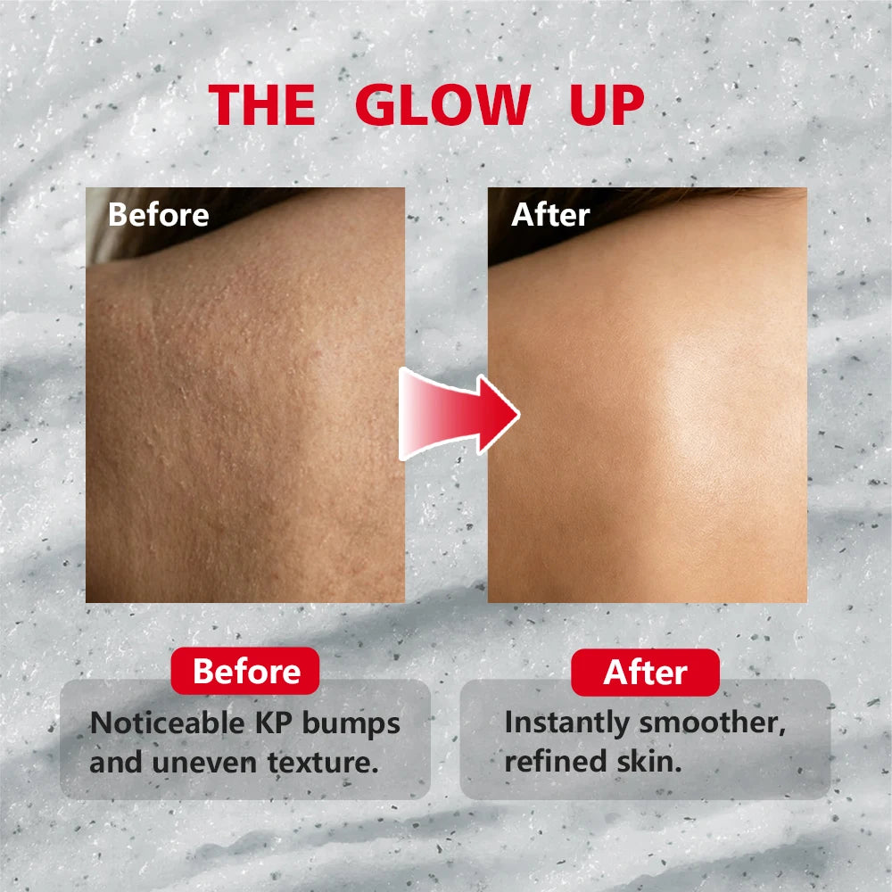 Bump Eradicator Body Scrub Smooth Soothed Brighten Skin Deep Moisturizing Formula Improve Rough Skin Gentle Remove Dead Skin Peaceful Pleasures Health and Wellness