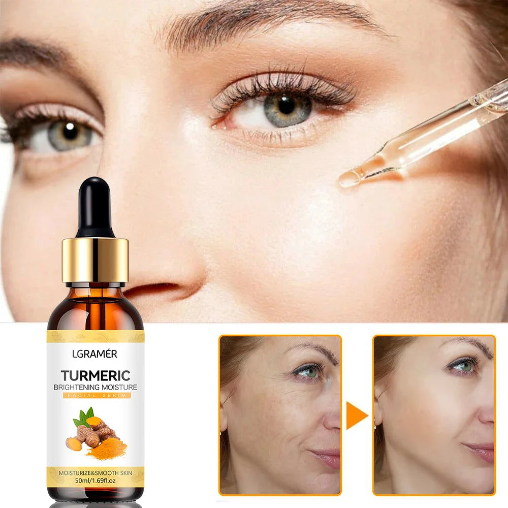 LGRAMER Turmeric Serum – Fade Dark Spots & Brighten Skin
