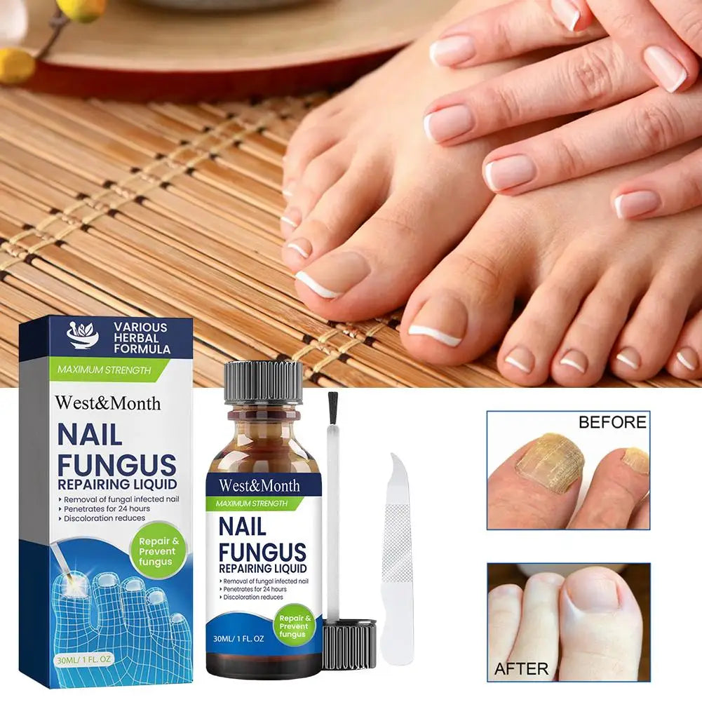 7-Day Nail Repair Serum & Nail Care Essence Oil Nail Repair Serum Peaceful Pleasures Health and Wellness